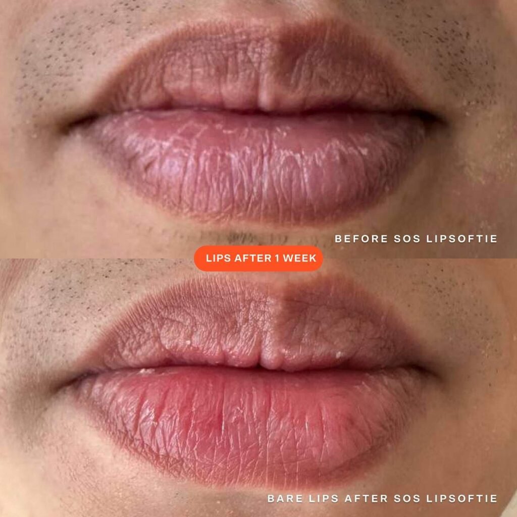 Tower 28 LipSoftie Lip Treatment