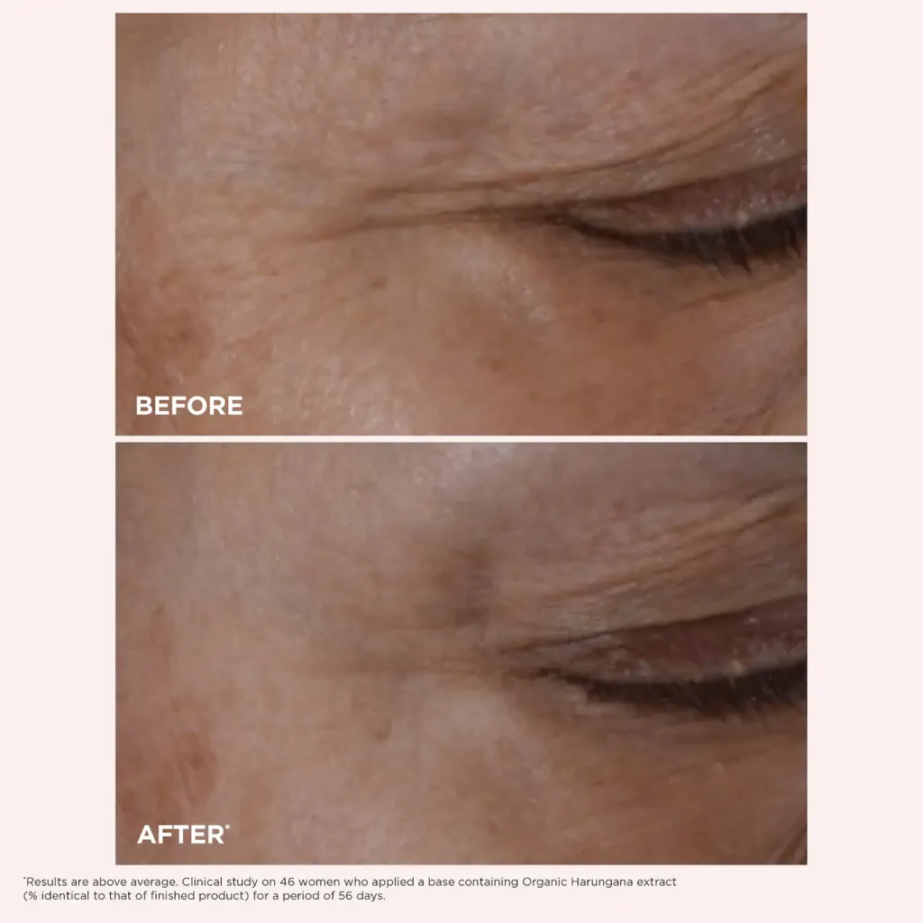 Clarins Total Eye Lift Eye Cream for Firming, Wrinkles, Dark Circles & Puffiness