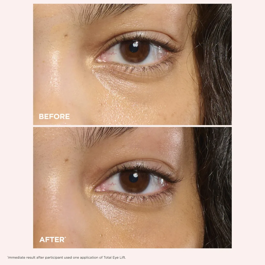 Clarins Total Eye Lift Eye Cream for Firming, Wrinkles, Dark Circles & Puffiness