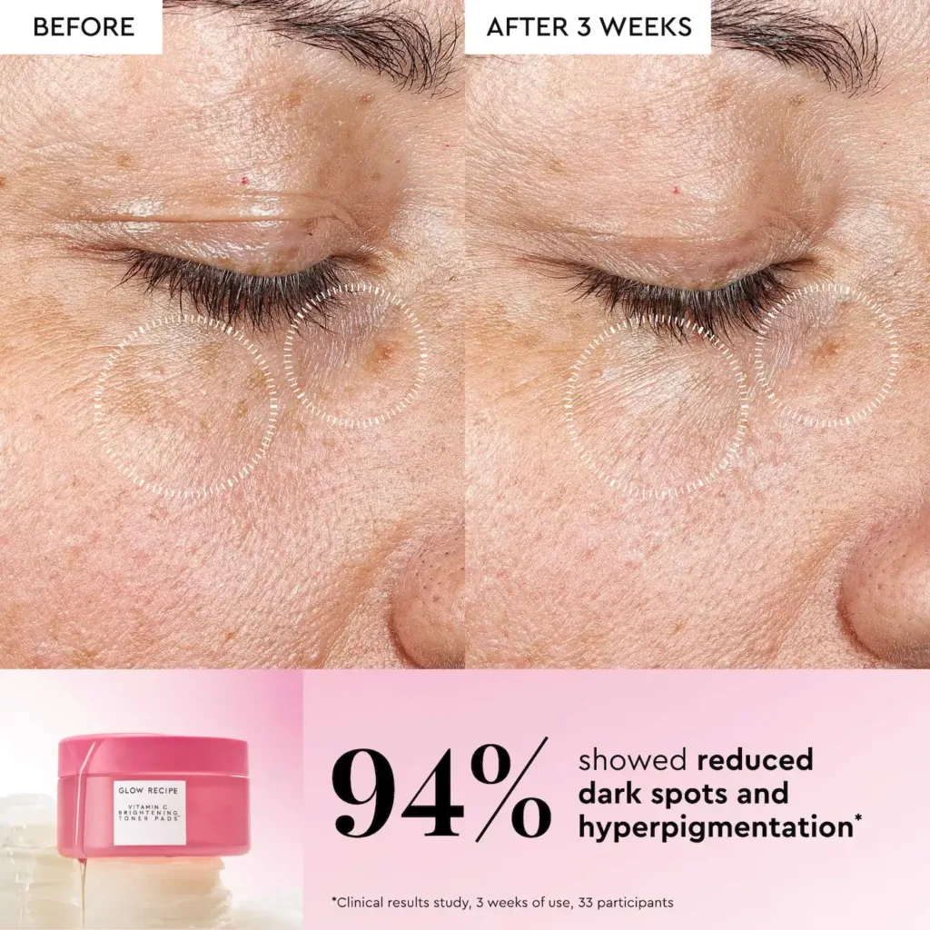 Glow Recipe Vitamin C Brightening Korean Guava Toner Pads for Undereye & Cheeks