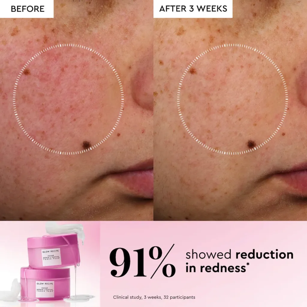 Glow Recipe PDRN Repair + Soothe Korean Prickly Pear Toner Pads for Skin Barrier Repair