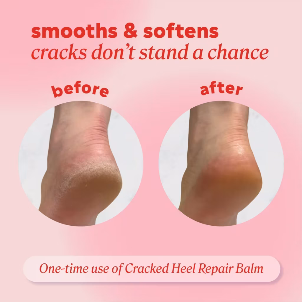 ONYX Professional Cracked Heel Repair Balm